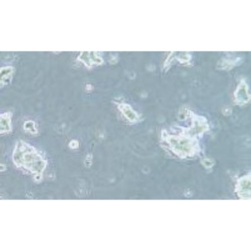 Human Small-Cell Lung Cancer Cell Line, #NCI-H209