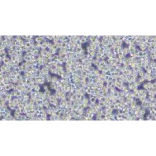 Human B-Cell Lymphoma Cell Line, #SU-DHL8