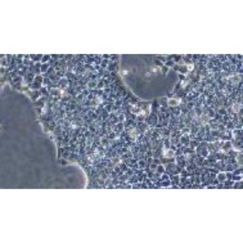Human Small-Cell Lung Cancer Cell Line, #NCI-H2227