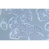 Human Breast Cancer Cell, #MDA-MB-175 VII