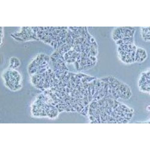 Human Breast Cancer Cell, #MDA-MB-175 VII