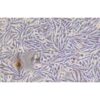 Human Melanoma Cell Line, #MNT1