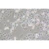 Human Breast Cancer Cell, #MX-1