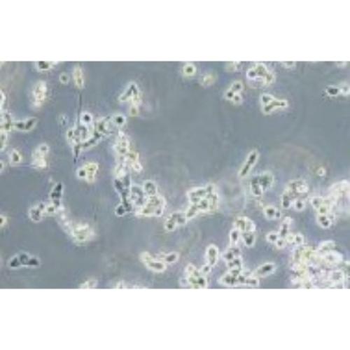 Human Non-Small-Cell Lung Cancer Cell Line, #NCI-H1581