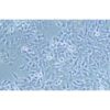 Human Non-Small-Cell Lung Cancer Cell Line, #NCI-H2110