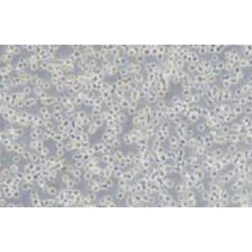 Human Presenting With Diffuse Histiocytic Lymphoma, #NU-DUL-1