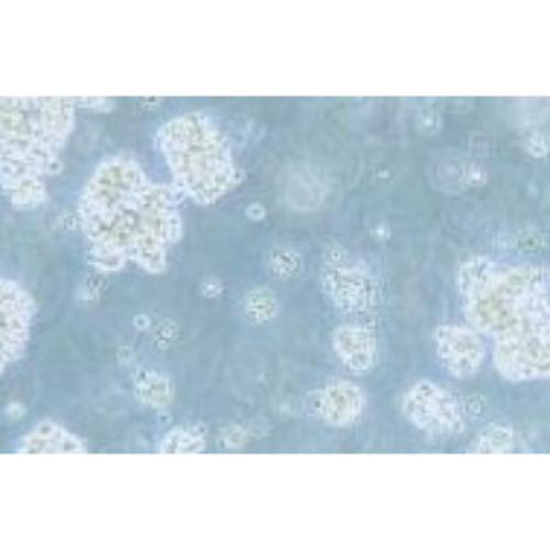 Human, Diffuse Large B-Cell Lymphoma Cell Line, #OCI-LY7