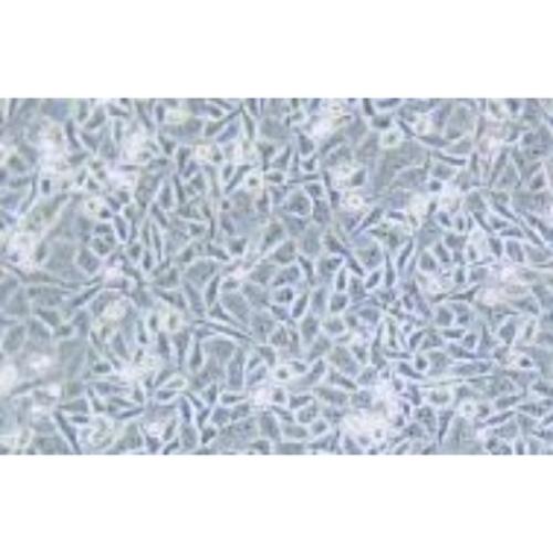 Human Metastatic Gastrointestinal Cancer Cell Line, #OVCAR-5