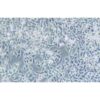 Human Colonic Adenocarcinoma Cell Line, #RKO