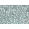 Human Gastric Carcinoma Cell, #SNU-719