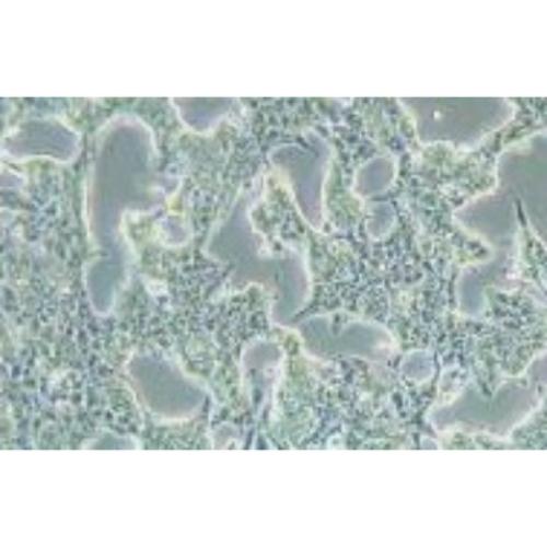 Human Gastric Carcinoma Cell, #SNU-719