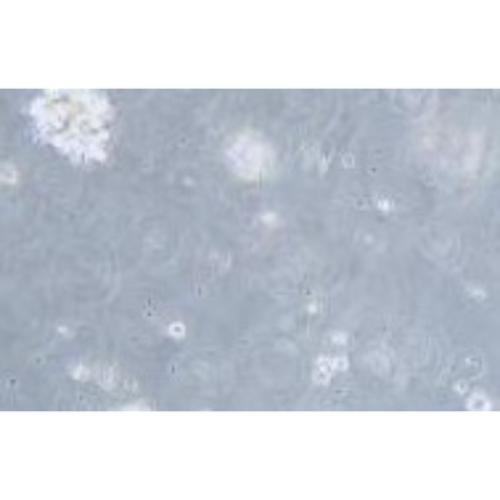 Human Diffuse Large B Lymphoma Cell Line, #TMD8