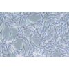 Astroglilastoma Of The Human Brain, #U87MG