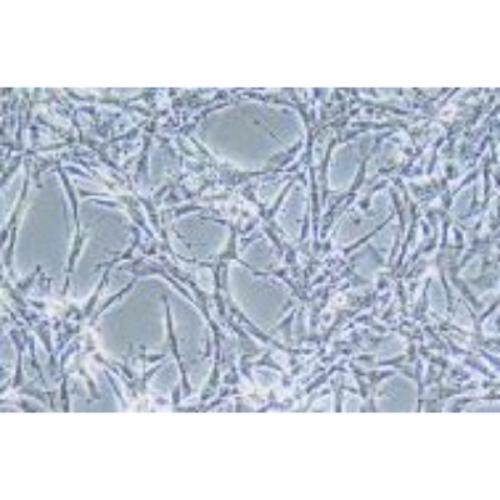 Astroglilastoma Of The Human Brain, #U87MG