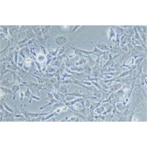 Human Endometriotic Cell Line, #12Z