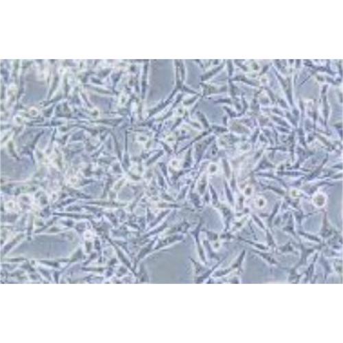 Uveal Melanoma Of The Human Eye, #92-1 [HUMAN UVEAL MELANOMA]