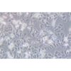 Human Lung Cancer Cell Line, #A-427