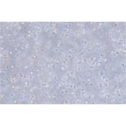 Human Peripheral Blood Lymphocytes, #ARH-77