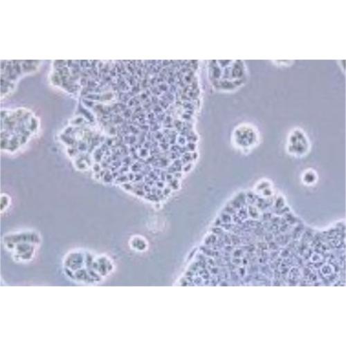 Human Breast Ductal Cancer Cell Line, #BT-483