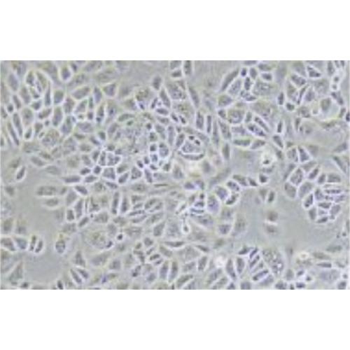 Human Breast Cancer Cell, #CAL-51