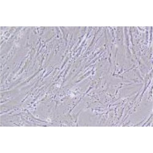 Human Normal Colonic Epithelial Cell Line (Limited Cell Line), #CCD-18CO