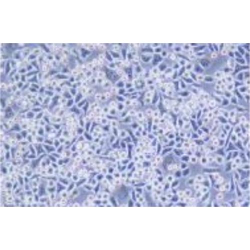 Human Lung Cancer Cell Line, #CHAGO-K-1