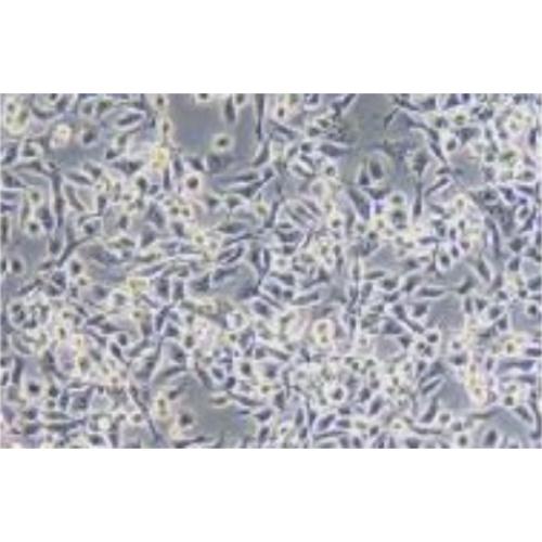 Human Lung Cancer Squamous Carcinoma Cell Line, #EBC-1