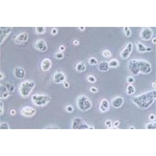 Human Breast Cancer Cell, #EFM-19