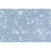 Human Kidney Carcinoma Of The Wilms Cell Line, #G-401