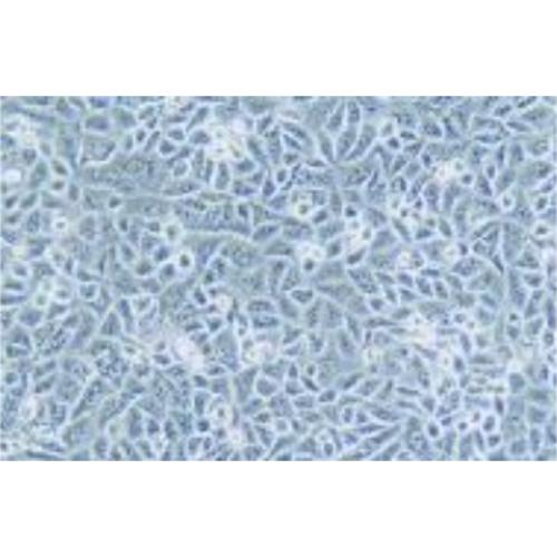 Human Kidney Carcinoma Of The Wilms Cell Line, #G-401