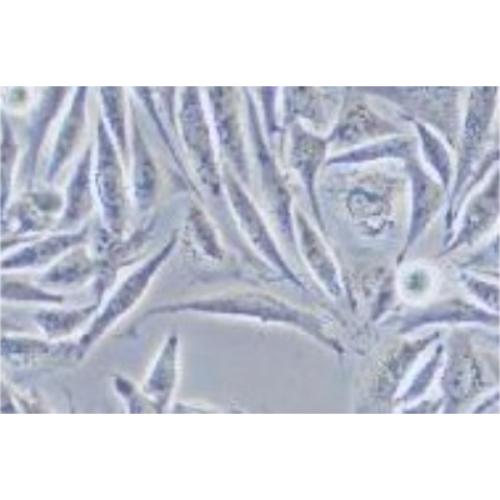 Human Gastrointestinal Stromal Tumor Cell Line, #GIST-T1