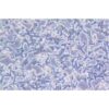 Human Colon Cancer Cell Line, #GP2D