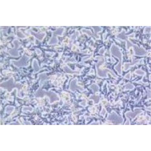 Human Colon Cancer Cell Line, #GP2D