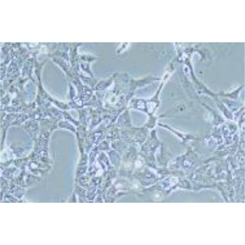 Human Breast Ductal Cancer Cell Line, #HCC70