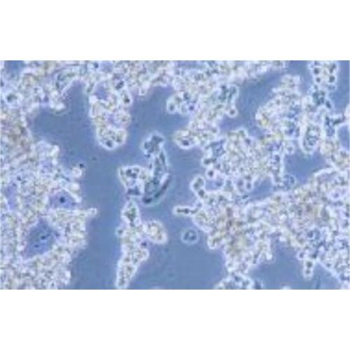 Human Breast Cancer Cell, #HCC1187