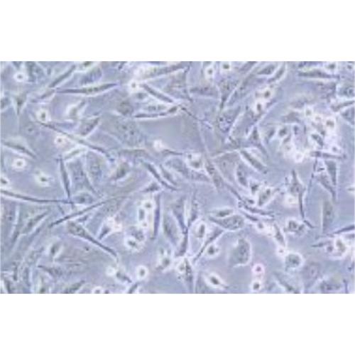 Human Non-Small-Cell Lung Cancer Cell Line, #HCC1359