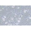 Human Breast Cancer Cell, #HCC1395