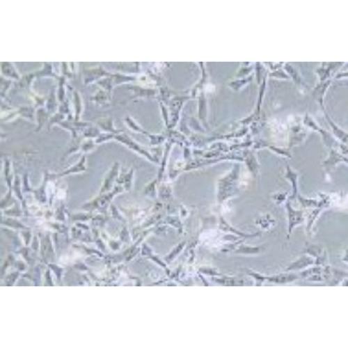 Human Breast Cancer Cell, #HCC1395