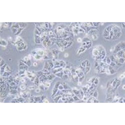 Human Breast Ductal Cancer Cell Line, #HCC1428