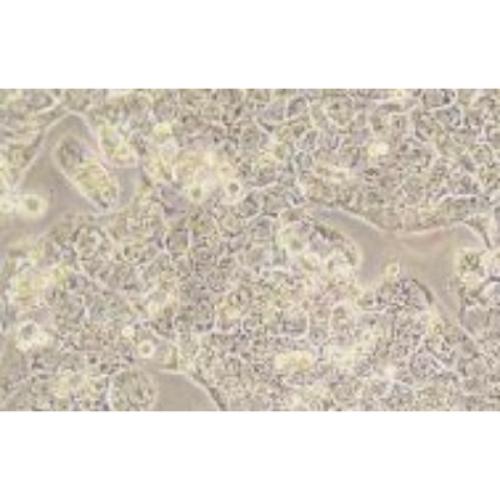 Human Breast Cancer Cell, #HCC1569