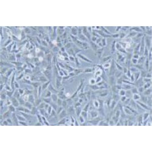 Human Brain Glioblastoma Cell Line, #LN-18
