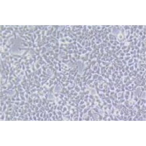 Human Embryonic Kidney Cell Line (HEKC), #LENTI-X293T?