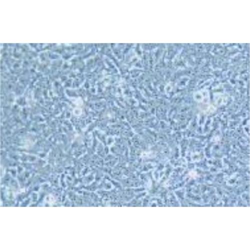 Human Oesophageal Squamous Cell Carcinoma Cell Line, #KYSE-450