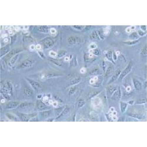 Human Breast Cancer Cell, #KPL-4