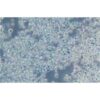 Human Osteosarcoma Cell Line, #KMS 11