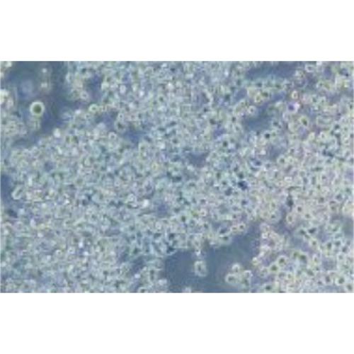 Human Osteosarcoma Cell Line, #KMS 11