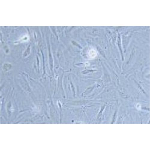 Human Mantle Cell Lymphoma Cell Line, #JHH-2