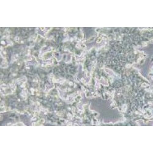 Human Gastric Adenocarcinoma Cell Line, #IM-95M