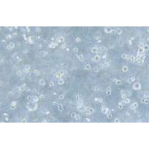 Human Peripheral Blood B Lymphocytes, #IM-9