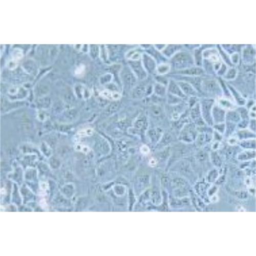 Human Ovarian Cancer Cell Lines, #IGROV-1